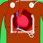 Heart surgery transplant-free online game